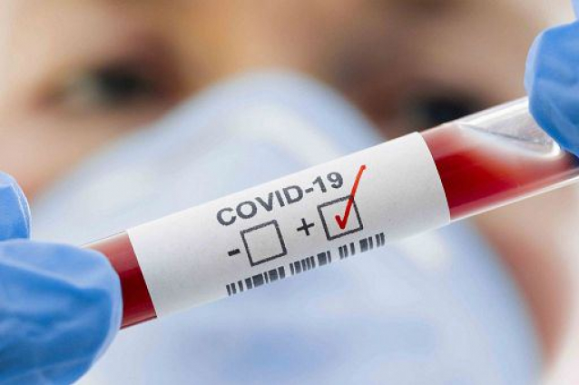 Covid-19, sono 4 i nuovi casi positivi a Castelfranco Piandiscò